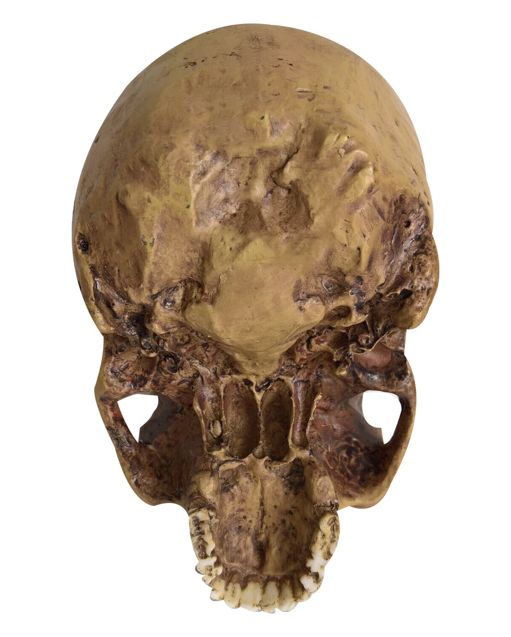 Antiker Totenschädel Ohne Unterkiefer 19cm 4 Antiker Totenschädel Ohne Unterkiefer 19cm – Bild 4