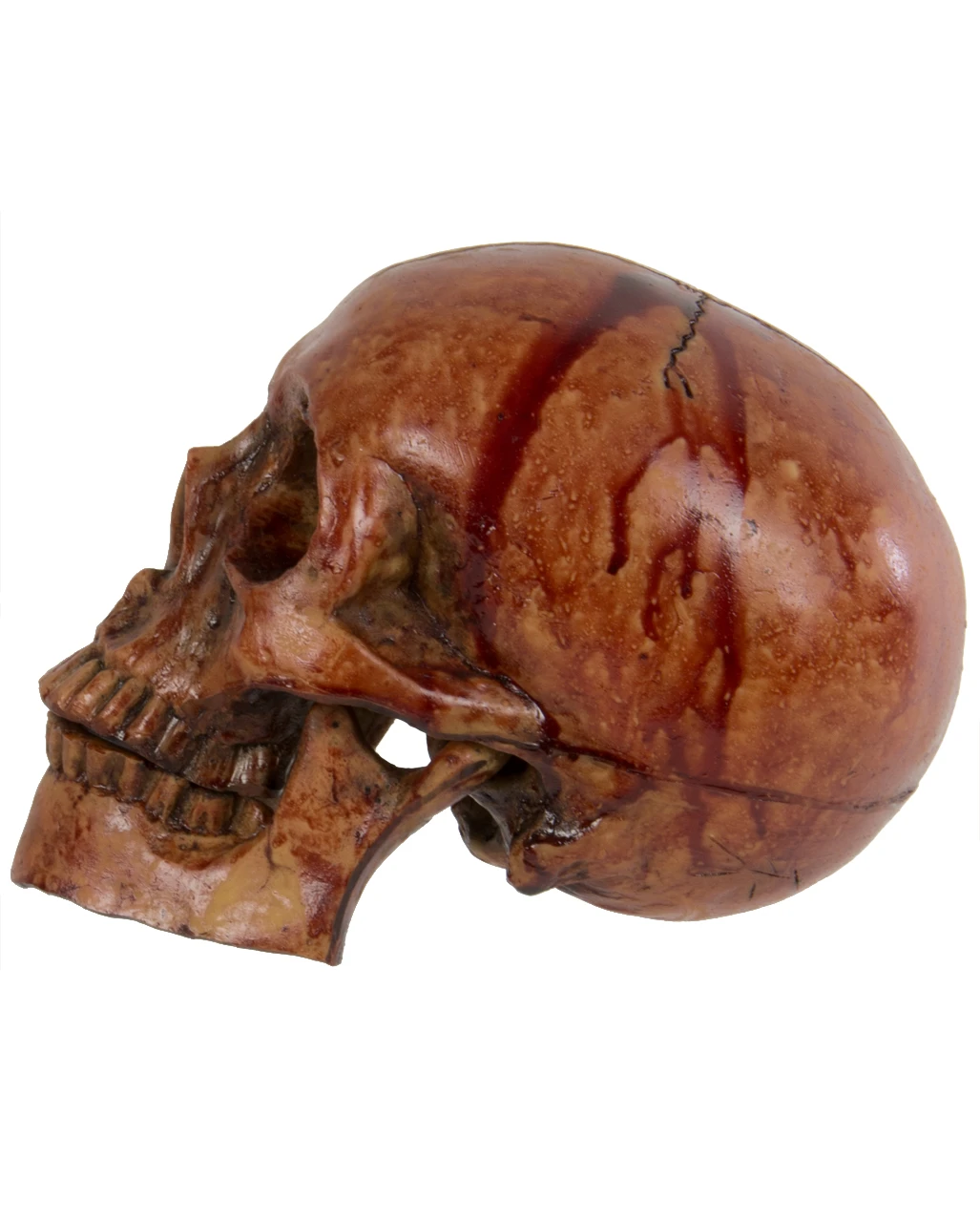 Blutiger Skull Mit Beweglichem Kiefer 2 Blutiger Skull Mit Beweglichem Kiefer – Bild 2